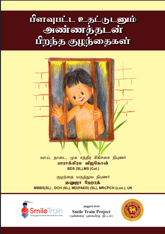 பிளவுபட்ட உதட்டுடனும் அண்ணத்துடனும் பிறந்த குழந்தைகள்